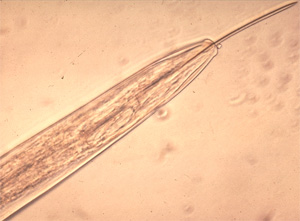 Nematode Diagnosis